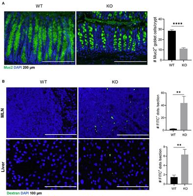 Impaired Barrier Function and Immunity in the Colon of Aldo-Keto Reductase 1B8 Deficient Mice